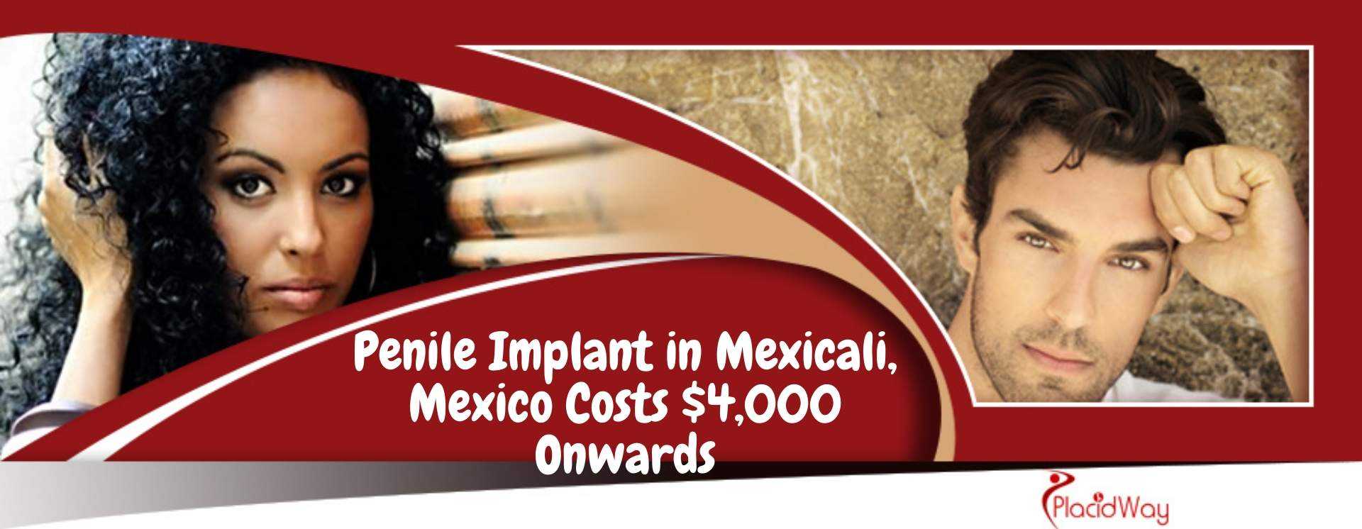 Penile Implant in Mexicali, Mexico